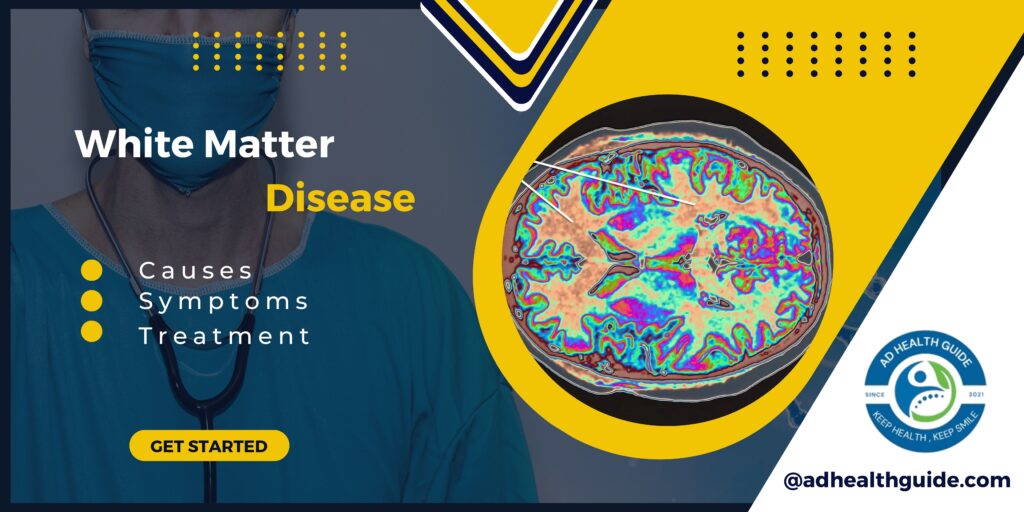 White Matter Disease