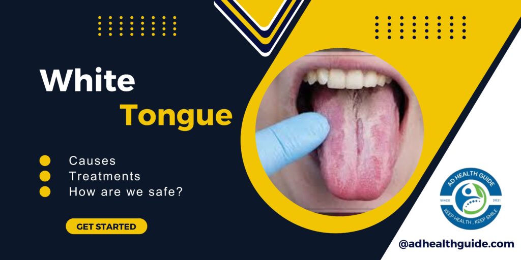 White Tongue